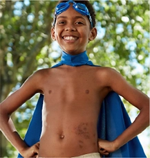 child with eczema on stomach 1
