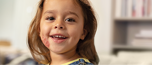 girl smiling with eczema on right cheek